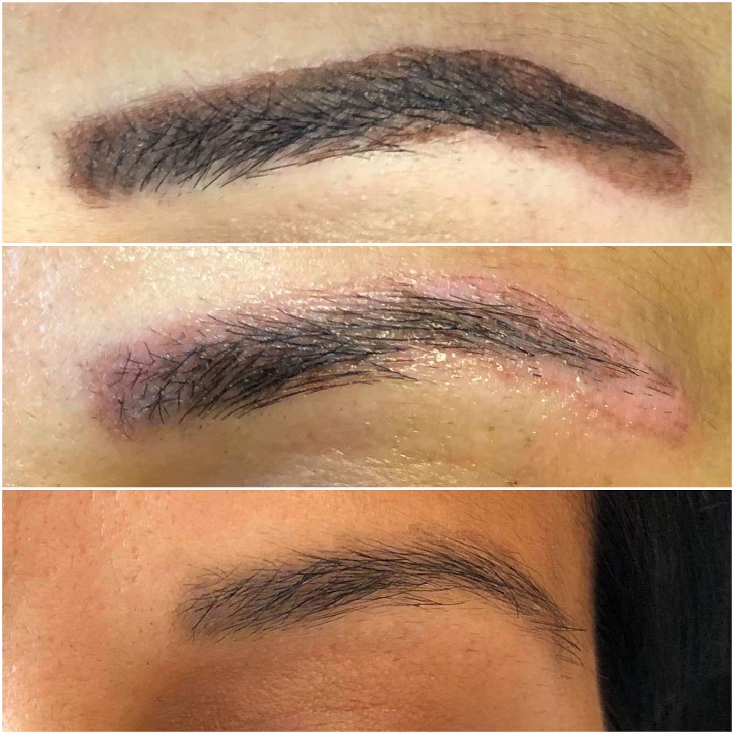 Emergency Removal Webinar for Botched Microblading, Powder brows, Lip Blush and Scalp Micropigmentation