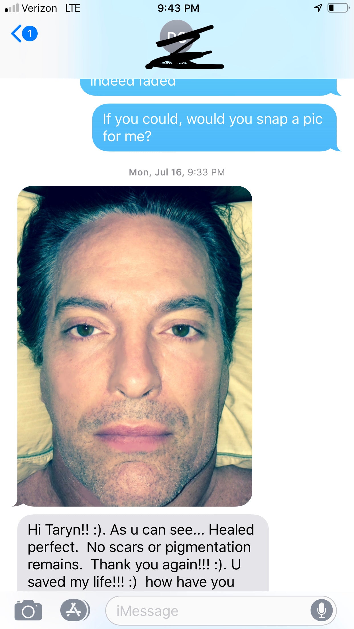 Emergency Removal Webinar for Botched Microblading, Powder brows, Lip Blush and Scalp Micropigmentation