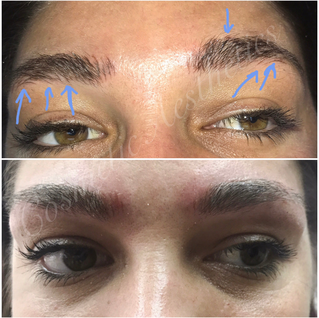 Emergency Removal Webinar for Botched Microblading, Powder brows, Lip Blush and Scalp Micropigmentation