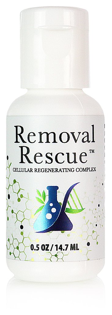Removal Rescue minis